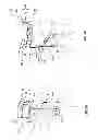 Fig. 07 - Orthopedic device for treating complications of the hip