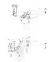 Fig. 08 - Orthopedic device for treating complications of the hip