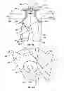 Fig. 09 - Orthopedic device for treating complications of the hip