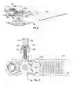 Fig. 22 - Orthopedic device for treating complications of the hip