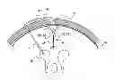 Fig. 01 - Minimally-advancing luminal catheter