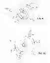 Fig. 07 - Minimally-advancing luminal catheter