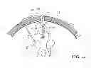 Fig. 09 - Minimally-advancing luminal catheter