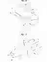Fig. 05 - Systems and methods for shunting fluid