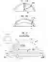 Fig. 20 - Systems and methods for shunting fluid