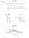 Fig. 30 - Systems and methods for shunting fluid