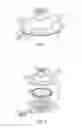 Fig. 02 - PUMPING DEVICE, AS FOR ENTERAL FEEDING ASSEMBLY