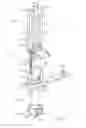 Fig. 02 - Non-Balloon Low Profile Feed Device With Insertion/Removal Tool