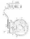 Fig. 02 - Reduced pressure, compression systems and apparatuses for use on joints