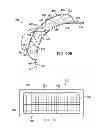 Fig. 09 - Reduced pressure, compression systems and apparatuses for use on joints