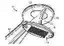 Fig. 01 - MICROSTRUCTURE DEVICE WITH REMOVABLE MICROSTRUCTURE PATCH
