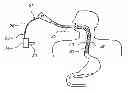 Fig. 01 - Cryogenic balloon ablation instruments and systems