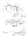 Fig. 02 - Cryogenic balloon ablation instruments and systems