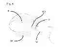 Fig. 02 - Capsulotomy device with suction cup compression chamber
