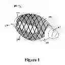 Fig. 02 - Cement-directing orthopedic implants