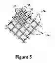Fig. 06 - Cement-directing orthopedic implants
