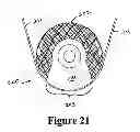 Fig. 22 - Cement-directing orthopedic implants