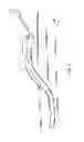 Fig. 02 - Temporary retention device