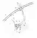 Fig. 01 - Endoscopic instrument with support foot