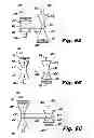 Fig. 07 - Surgical fastener applier