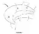 Fig. 02 - Apparatus and method for heart valve repair