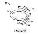 Fig. 08 - Apparatus and method for heart valve repair