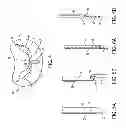 Fig. 05 - GRIPPER PUSHER MECHANISM FOR TISSUE APPOSITION SYSTEMS