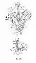 Fig. 16 - GRIPPER PUSHER MECHANISM FOR TISSUE APPOSITION SYSTEMS