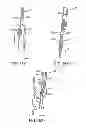 Fig. 23 - GRIPPER PUSHER MECHANISM FOR TISSUE APPOSITION SYSTEMS
