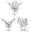 Fig. 33 - GRIPPER PUSHER MECHANISM FOR TISSUE APPOSITION SYSTEMS
