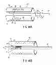 Fig. 48 - GRIPPER PUSHER MECHANISM FOR TISSUE APPOSITION SYSTEMS