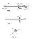 Fig. 02 - OCCLUSIVE CINCHING DEVICES AND METHODS OF USE