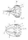 Fig. 08 - VASCULAR FILTER