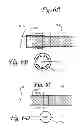 Fig. 07 - Dynamic microvalve protection device with associated balloon element for therapeutic intravascular procedures