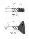 Fig. 08 - Dynamic microvalve protection device with associated balloon element for therapeutic intravascular procedures