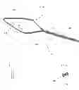 Fig. 02 - SURGICAL SUTURE RETRIEVING AND PASSING SYSTEM