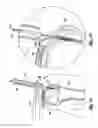 Fig. 02 - Knotless suture anchoring device having deforming section to accommodate sutures of various diameters