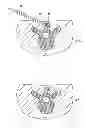Fig. 01 - System and Method for Performing Spinal Stabilization