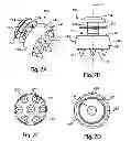Fig. 08 - Spinous Process Fusion Implants and Insertion, Compression, and Locking Instrumentation