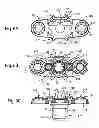Fig. 07 - Spinous Process Fusion Implants and Insertion, Compression, and Locking Instrumentation