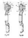 Fig. 09 - Spinous Process Fusion Implants and Insertion, Compression, and Locking Instrumentation
