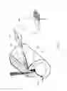 Fig. 06 - Extended pain relief via high frequency spinal cord modulation, and associated systems and methods