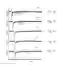 Fig. 08 - Extended pain relief via high frequency spinal cord modulation, and associated systems and methods