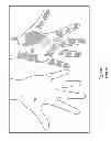 Fig. 02 - LASER METHOD FOR TREATING HYPERHIDROSIS TARGETING SWEAT GLANDS