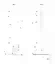 Fig. 06 - Implant delivery and deployment system and method