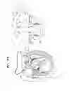Fig. 09 - Anchoring of prosthetic valve supports