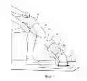 Fig. 02 - Alignment Device For a Prosthetic Leg Sleeve Pin