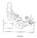 Fig. 09 - Alignment Device For a Prosthetic Leg Sleeve Pin