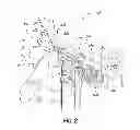 Fig. 03 - Disablement of wind turbines in a wind park