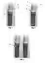 Fig. 02 - Tools for customized design of dental restorations